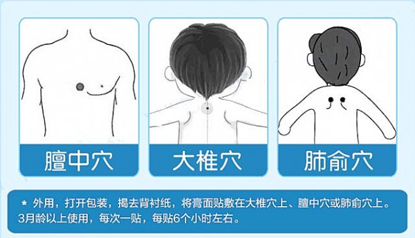 宝宝咳嗽拖不得 家中常备葵花童博士止咳贴 外用便捷更安心